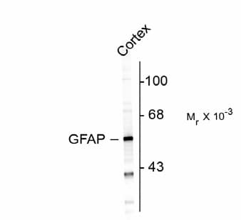 GFAP Antibody