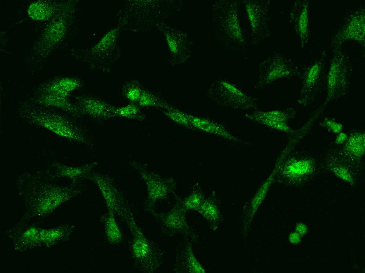 Polyclonal Rabbit anti-Human ZNF282 Antibody (IF)
