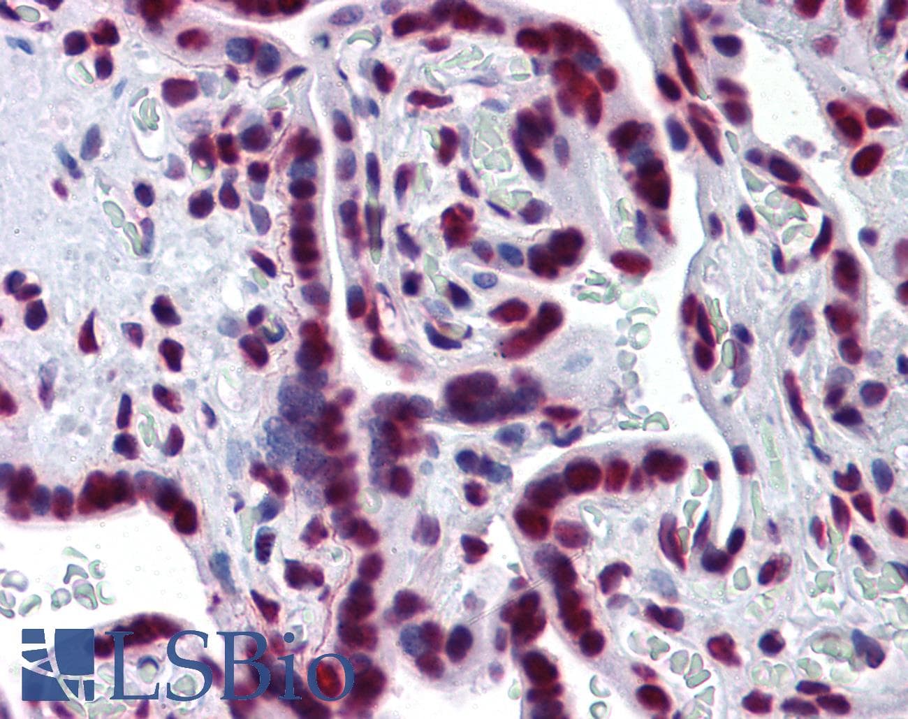 PathPlus™ Monoclonal Mouse anti-Human SF1 Antibody (clone 2E12, IHC, IF, WB)