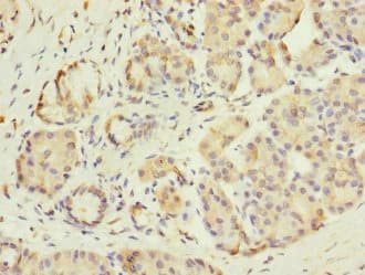 GIPR / GIP Receptor Antibody