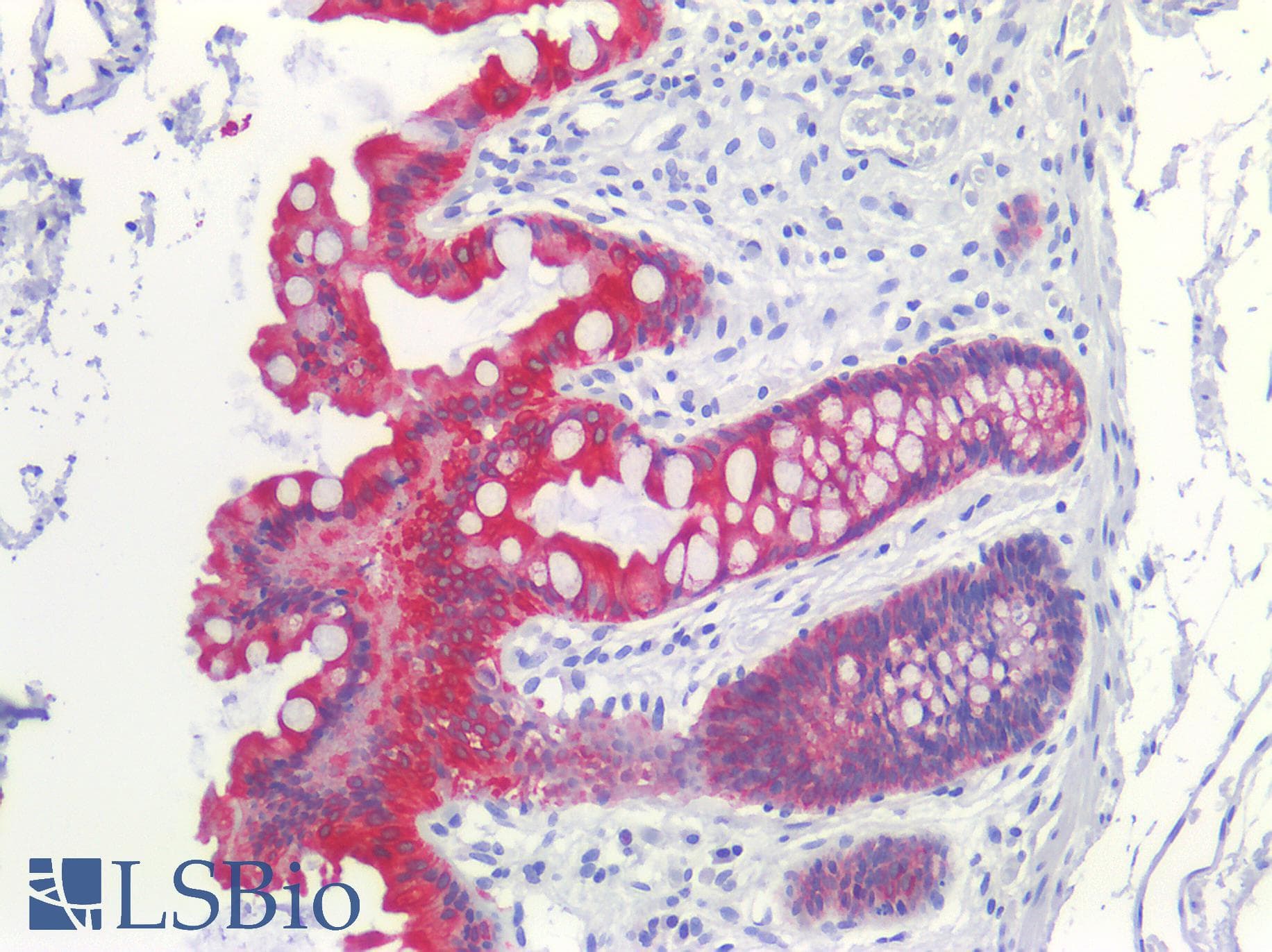 Polyclonal Rabbit anti-Human ST14 / Matriptase Antibody (C-terminal, IHC, WB)