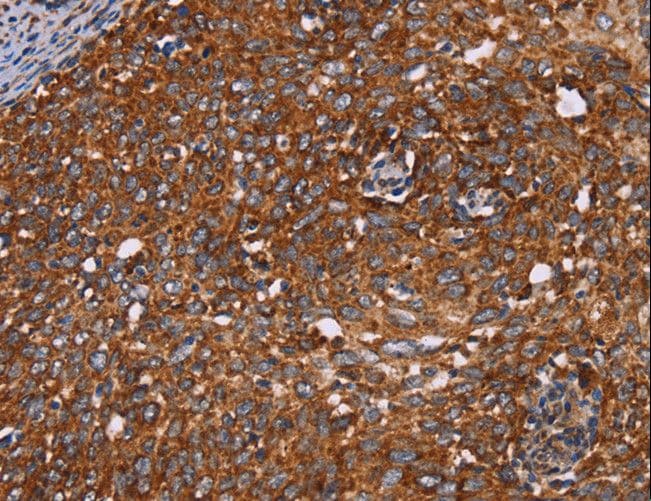 CYP2W1 Antibody