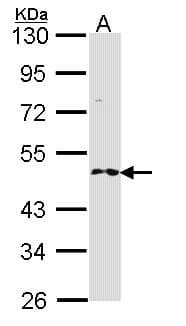 IHC-plus™ RNF25 Antibody