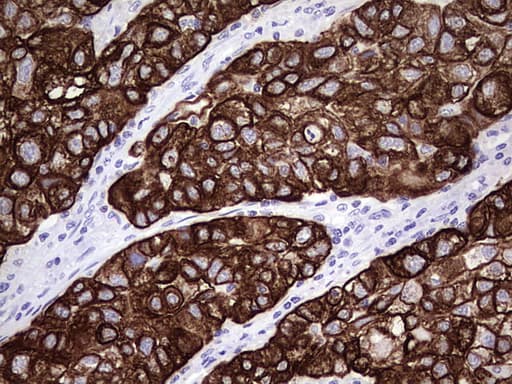 KRT7 / CK7 / Cytokeratin 7 Antibody (aa1-114, clone UMAB161, Carrier-free)