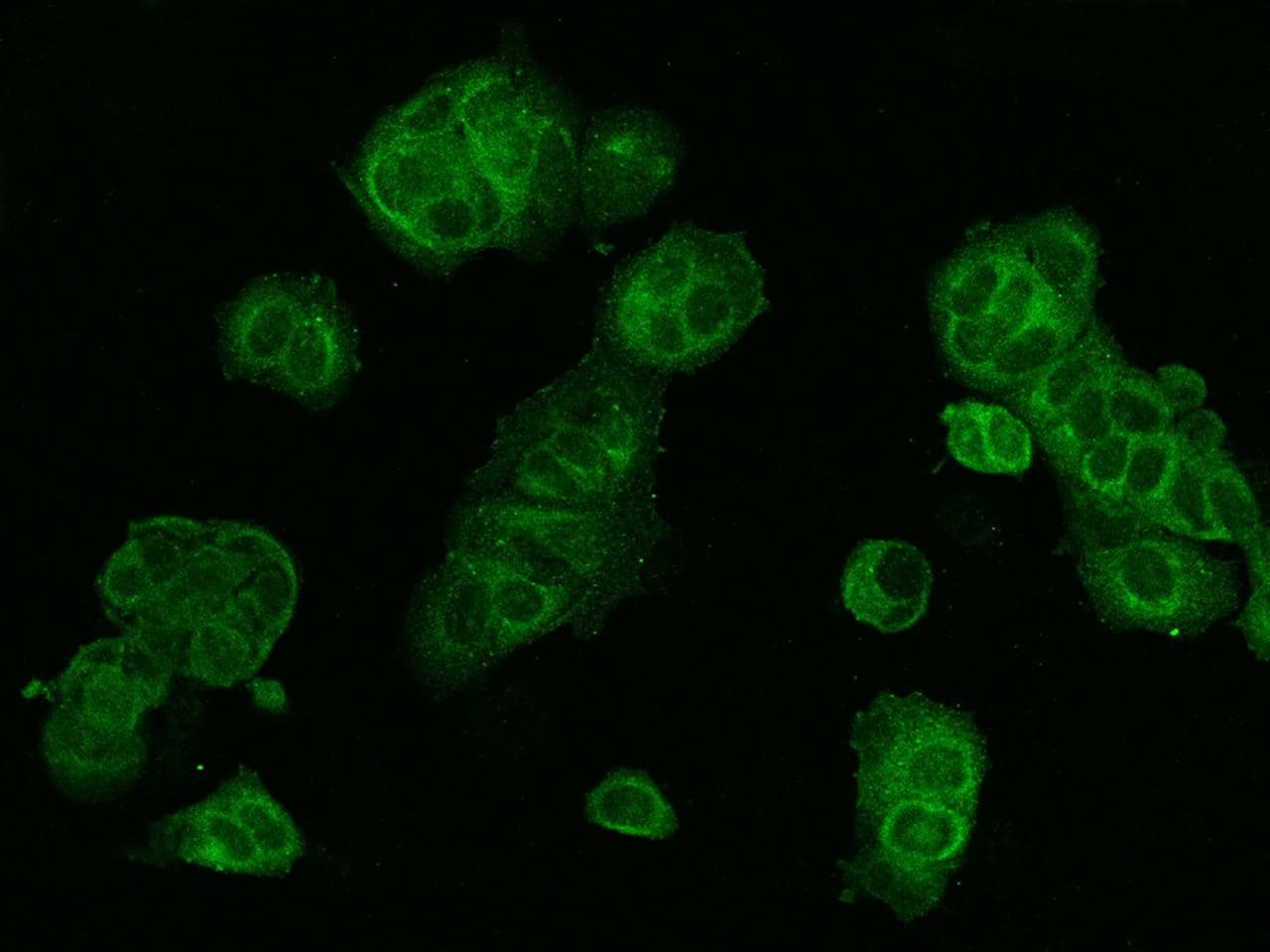Polyclonal Rabbit anti-Human WWOX Antibody (IHC, IF, WB)