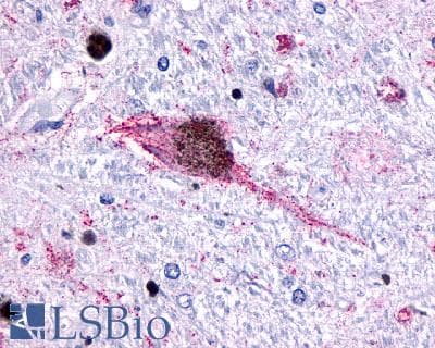 PathPlus™ HTR6 / 5-HT6 Receptor Antibody (C-Terminus)