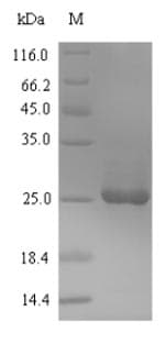 Soy Bean BBI Protein (Recombinant 6His-SUMO, N-terminus)