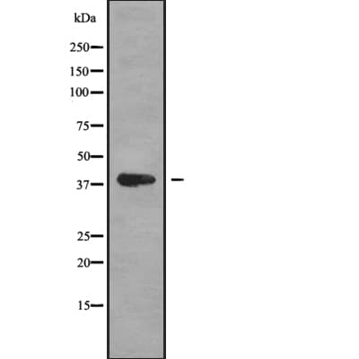Polyclonal Rabbit anti-Human MAGEB1 Antibody (IF, WB)