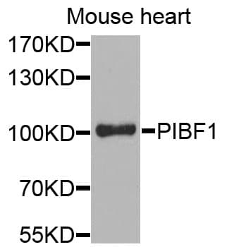PIBF1 / PIBF Antibody