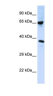 C6orf134 / ATAT1 Antibody (aa108-157)