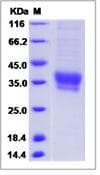 Monkey-Cynomolgus IL20RB Protein (Recombinant His,C-terminus)
