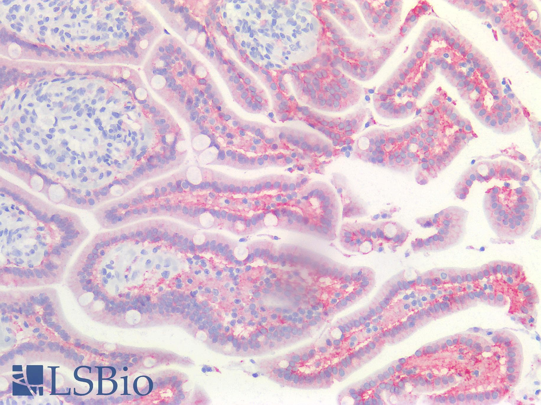 PathPlus™ CLDN4 / Claudin 4 Antibody (C-Terminus, clone 3E2C1)