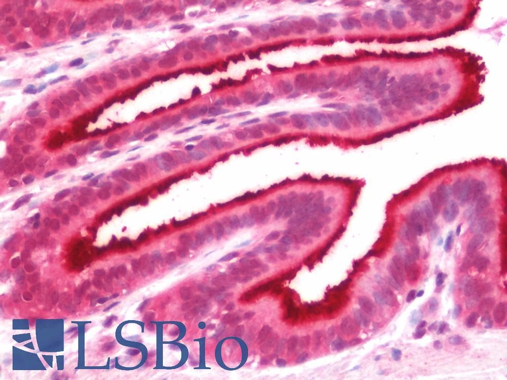 IHC-plus™ ZFP36L1 Antibody (aa58-107)