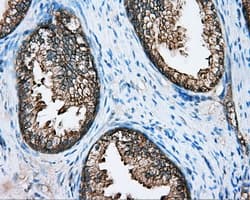 DNTTIP1 / TDIF1 Antibody (clone OTI1E2)