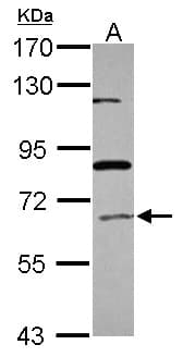 ACOX1 / ACOX Antibody (Internal)