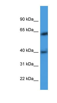 ARPM1 Antibody (aa21-70)