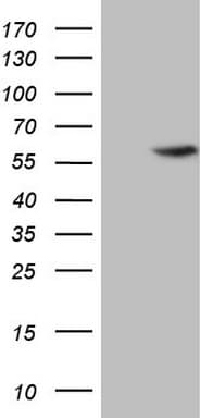 ABAT Antibody (aa29-323, clone OTI7H1)