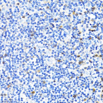 S100A4 / FSP1 Antibody
