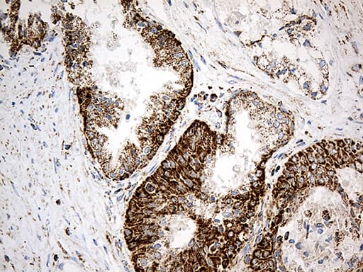 MCAD / ACADM Antibody (clone OTI2G7)