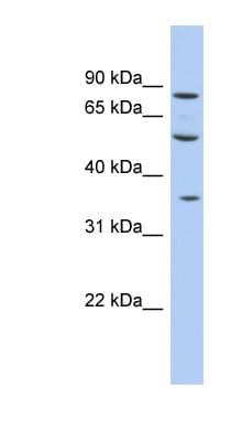 Polyclonal Rabbit anti-Human FAM63A Antibody (C-Terminus, WB)