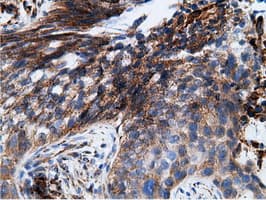 KHK / Ketohexokinase Antibody (clone OTI3D1)