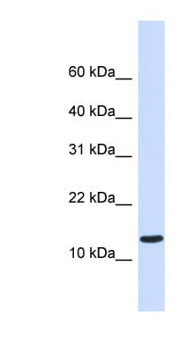 Polyclonal Rabbit anti-Human C1orf95 Antibody (C-Terminus, WB)