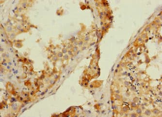 NRBP1 / NRBP Antibody