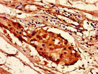 Polyclonal Rabbit anti-Human HIST1H2AI Antibody (IHC, IF, WB)