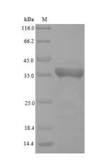 Orangutan GPX4 / MCSP Protein (Recombinant 6His-SUMO, N-terminus)