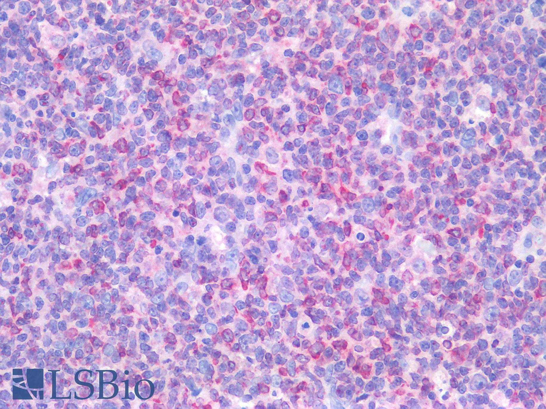 IHC-plus™ AML1 / RUNX1 Antibody