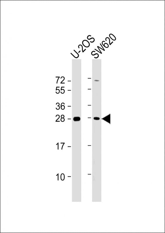 TK1 / TK / Thymidine Kinase Antibody (Internal)