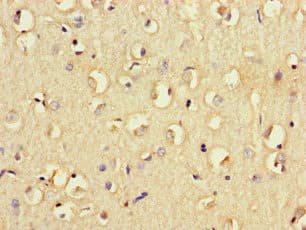 CD32B Antibody