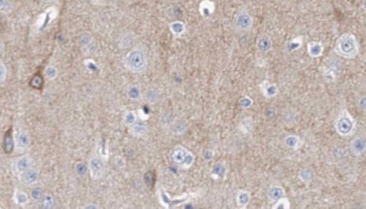 Dynactin 3 / DCTN3 Antibody