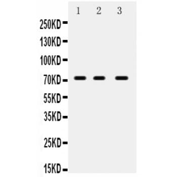 Polyclonal Rabbit anti-Human ABCG5 Antibody (aa197-221, WB)