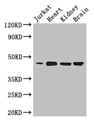 Polyclonal Rabbit anti-Human DOK2 Antibody (IHC, IF, WB)