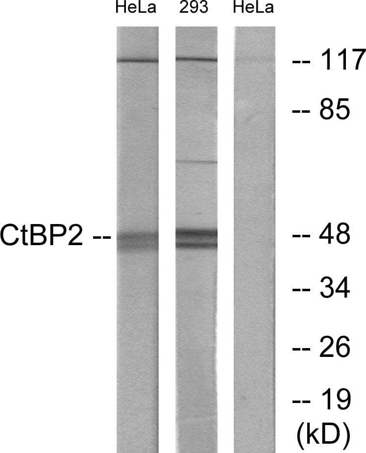 CTBP2 Antibody