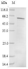 Human CRBN / Cereblon Protein (Recombinant 9His, C-terminus)