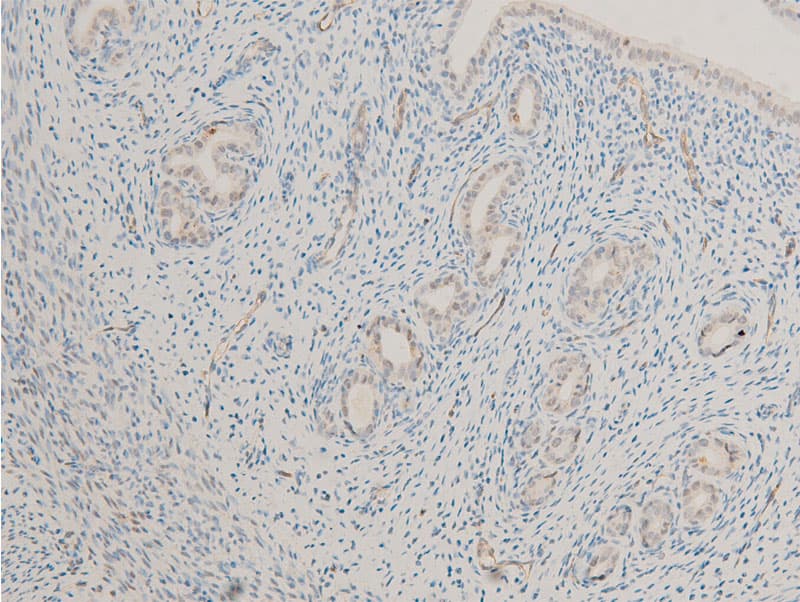 Polyclonal Rabbit anti-Human MITF Antibody (phospho-Ser180,phospho-Ser73, IHC, IF, WB)