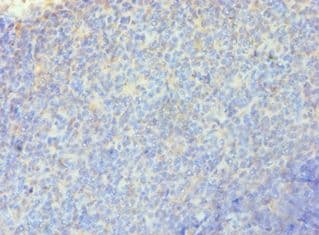 Polyclonal Rabbit anti-Human RRM2B / P53R2 Antibody (aa1-351, IHC, WB)
