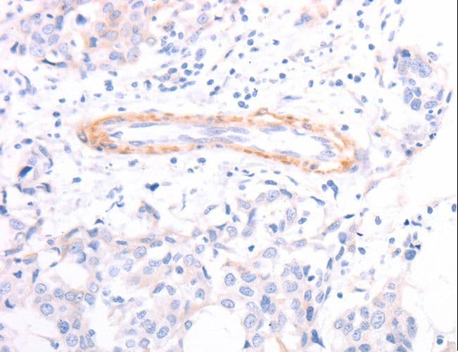 TPM1 / Tropomyosin Antibody