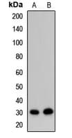 Polyclonal Rabbit anti-Human EXOSC8 Antibody (WB)