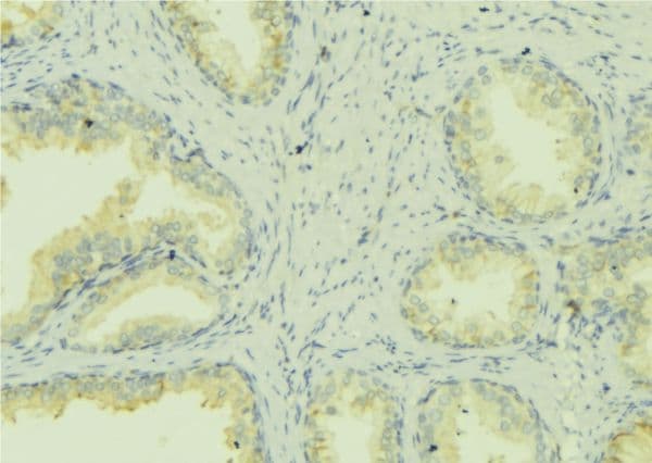 Polyclonal Rabbit anti-Human MNK / ATP7A Antibody (IHC, WB)