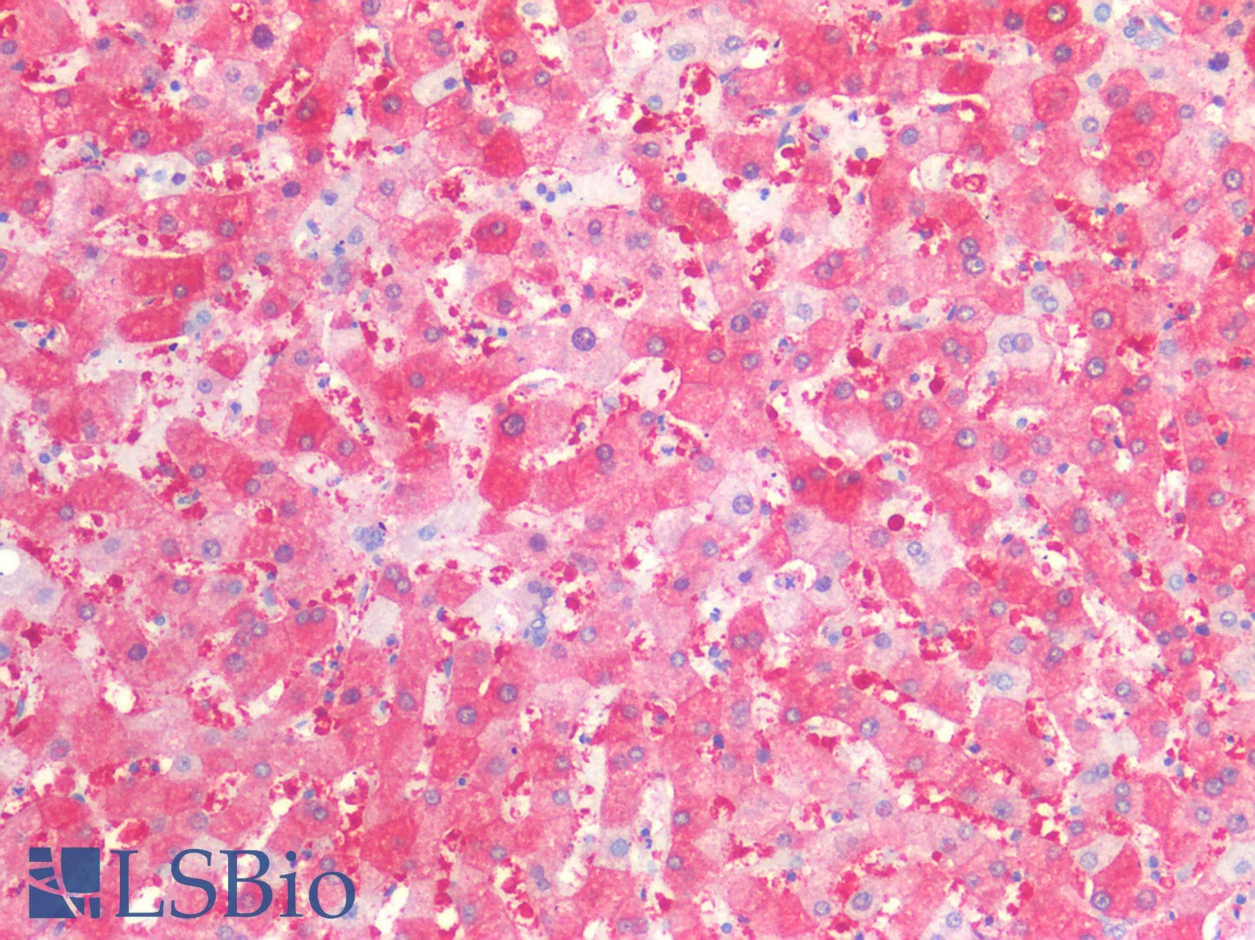 IHC-plus™ Polyclonal Rabbit anti-Human SIAH2 Antibody (IHC)