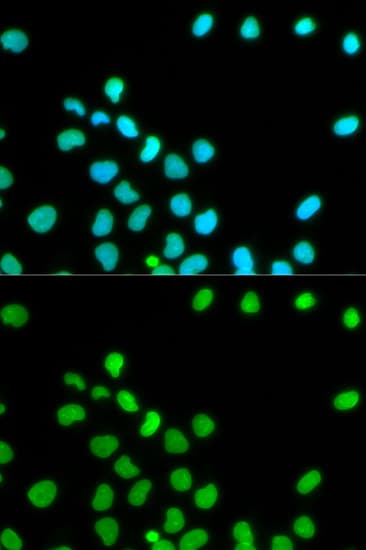 LMNA / Lamin A+C Antibody