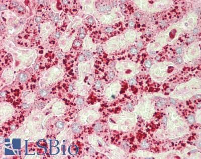 PathPlus™ CTSD / Cathepsin D Antibody (Internal)