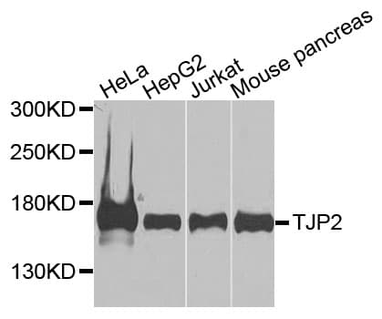 IHC-plus™ Polyclonal Rabbit anti-Human TJP2 / ZO2 / ZO-2 Antibody (IHC, WB)