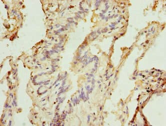 STX5 / Syntaxin 5 Antibody