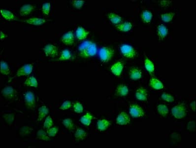 IHC-plus™ CTNNB1 / Beta Catenin Antibody