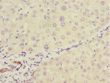 GTF2A2 / TFIIA Antibody