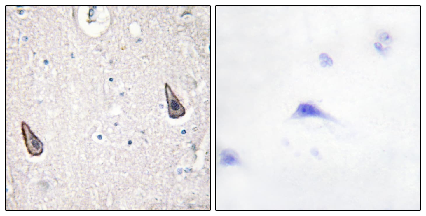 Polyclonal Rabbit anti-Human ADCY5+6 Antibody (aa931-980, IHC, IF)